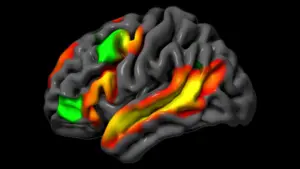 Beyond Words: New MIT Research Reveals Logical Reasoning Operates Independently of Language