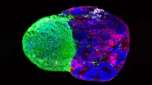 Deciphering the Blueprint: How Metabolism and Physical Signals Shape the Human Brain