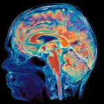 Dual Origins: Stanford Researchers Discover the Brain Is Built from Two Distinct Evolutionary Systems