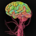 Immune Cells From the Body Enter the Human Brain During Aging, Stanford Study Finds