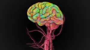 Immune Cells From the Body Enter the Human Brain During Aging, Stanford Study Finds