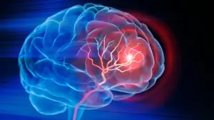 Injectable Biomaterial Offers New Hope for Brain Tissue Repair After Ischemic Stroke