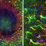 New Insights Into Brain Repair: Adult Astrocytes Found to Regenerate Through Unique Nuclei Migration
