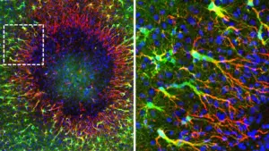 New Insights Into Brain Repair: Adult Astrocytes Found to Regenerate Through Unique Nuclei Migration