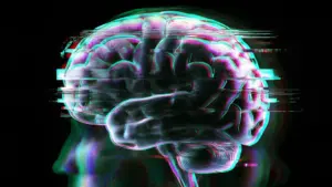 Beyond the Diagnosis: New Research Uncovers Five Distinct Brain Patterns in Depression