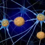 Blocking Immune Response May Stop Alzheimer’s Brain Cell Loss, New Research Finds