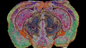 Decoding the Brain’s Chemical Architecture: Researchers Unveil the First Lipid Brain Atlas
