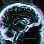 Study Reveals Distinct Patterns of Accelerated Brain Aging Across Diverse Neurological and Psychiatric Conditions